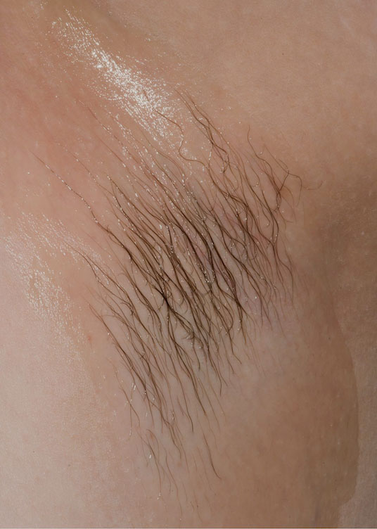 Armpit 1